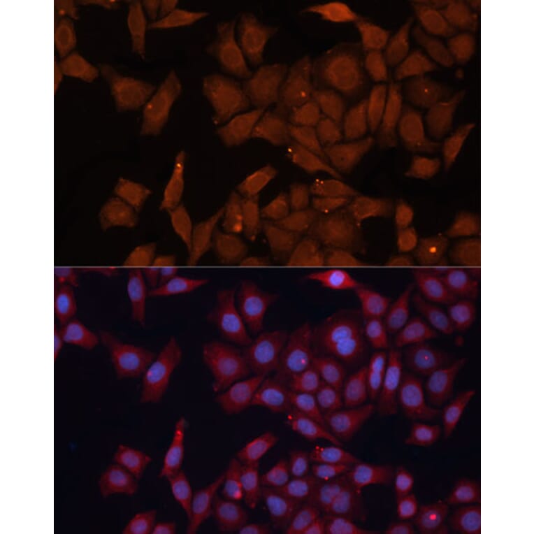 Immunofluorescence - Anti-HMGCS1 Antibody (A9326) - Antibodies.com
