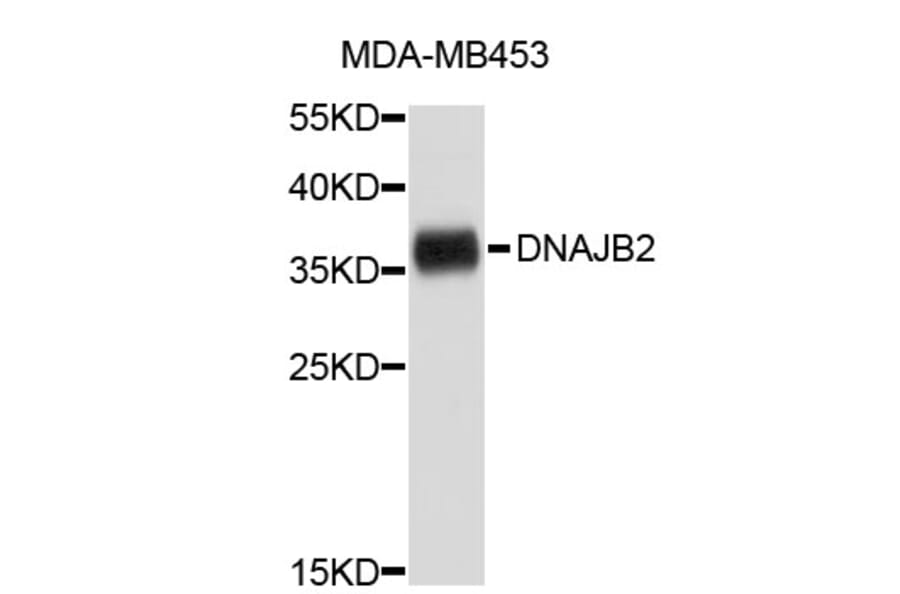 Western Blot - Anti-DNAJB2 Antibody (A3919) - Antibodies.com