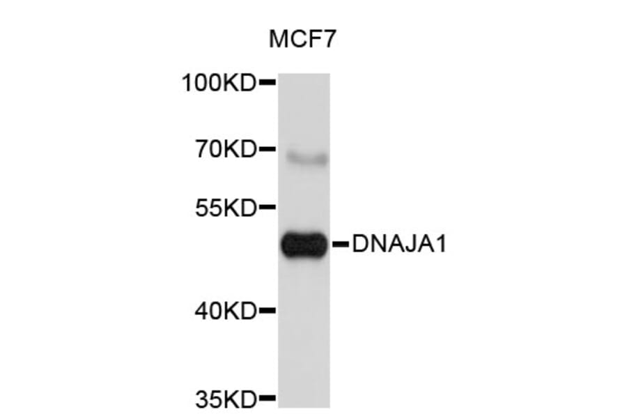 Western Blot - Anti-DNAJA1 Antibody (A3920) - Antibodies.com
