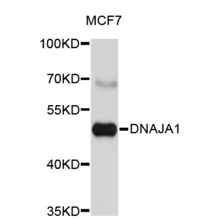 Western Blot - Anti-DNAJA1 Antibody (A3920) - Antibodies.com