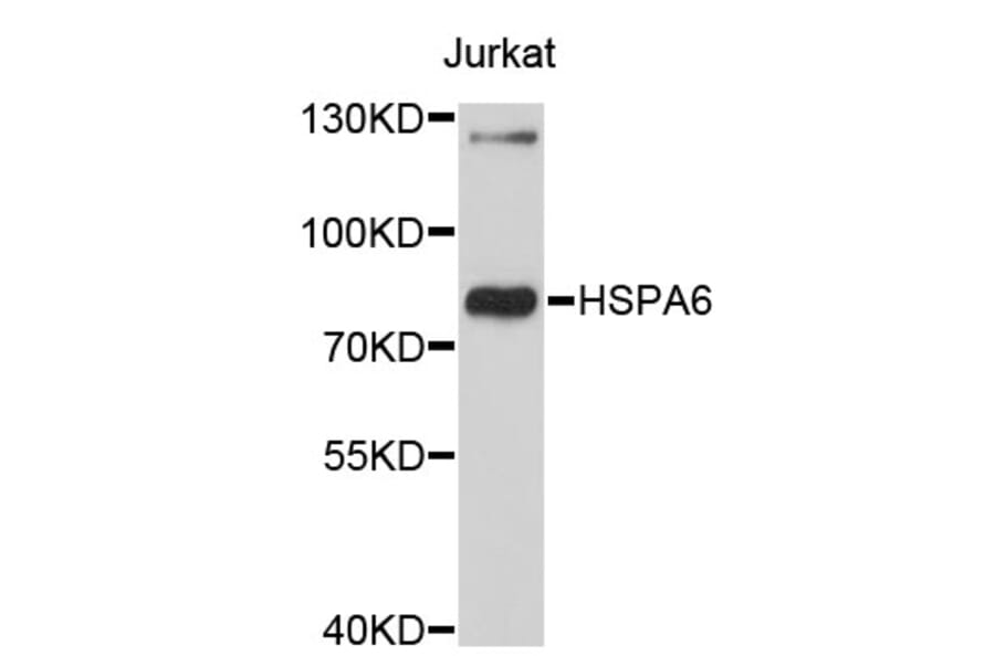 Western Blot - Anti-HSPA6 Antibody (A3922) - Antibodies.com