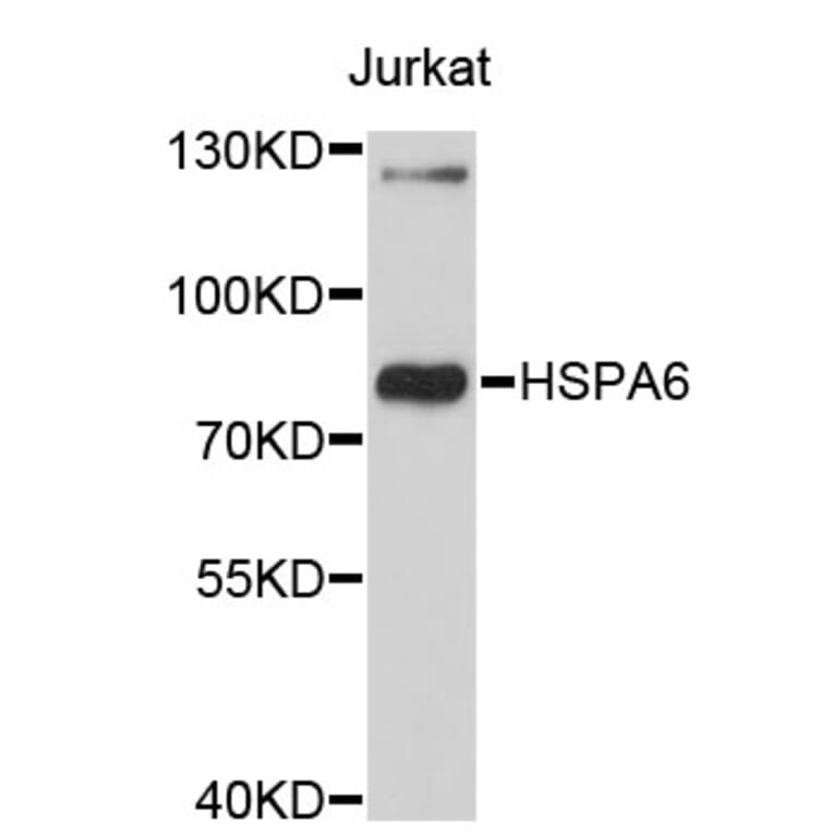 Western Blot - Anti-HSPA6 Antibody (A3922) - Antibodies.com