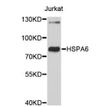 Western Blot - Anti-HSPA6 Antibody (A3922) - Antibodies.com
