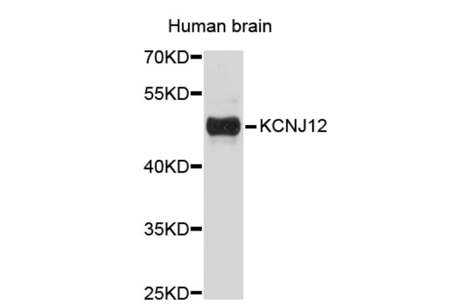 Western Blot - Anti-KCNJ12 Antibody (A3930) - Antibodies.com