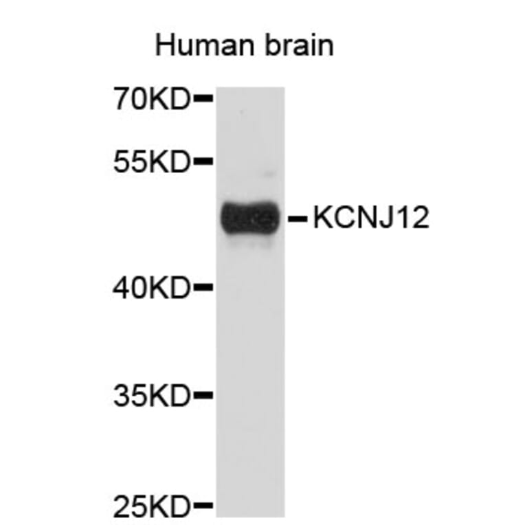 Western Blot - Anti-KCNJ12 Antibody (A3930) - Antibodies.com