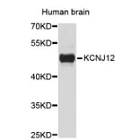 Western Blot - Anti-KCNJ12 Antibody (A3930) - Antibodies.com