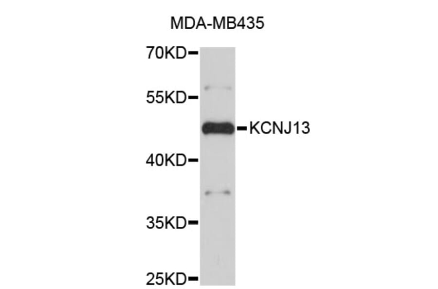 Western Blot - Anti-KCNJ13 Antibody (A3931) - Antibodies.com