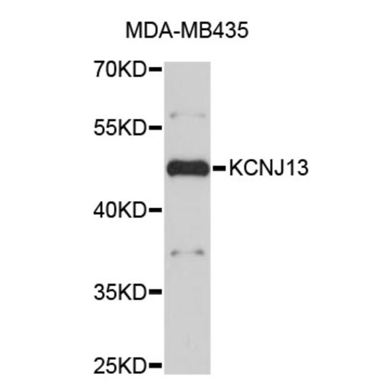 Western Blot - Anti-KCNJ13 Antibody (A3931) - Antibodies.com