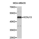 Western Blot - Anti-KCNJ13 Antibody (A3931) - Antibodies.com