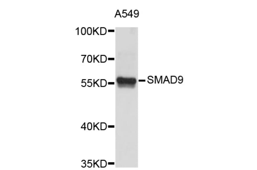 Western Blot - Anti-SMAD9 Antibody (A3950) - Antibodies.com