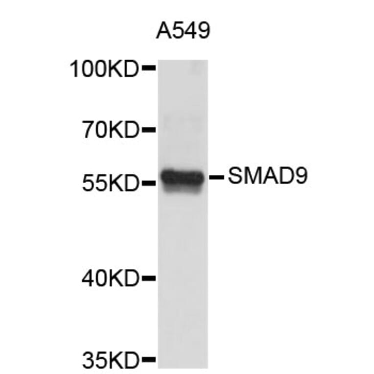 Western Blot - Anti-SMAD9 Antibody (A3950) - Antibodies.com