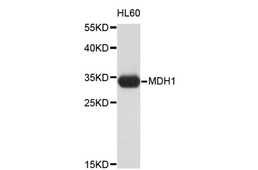 Western Blot - Anti-MDH1 Antibody (A3955) - Antibodies.com