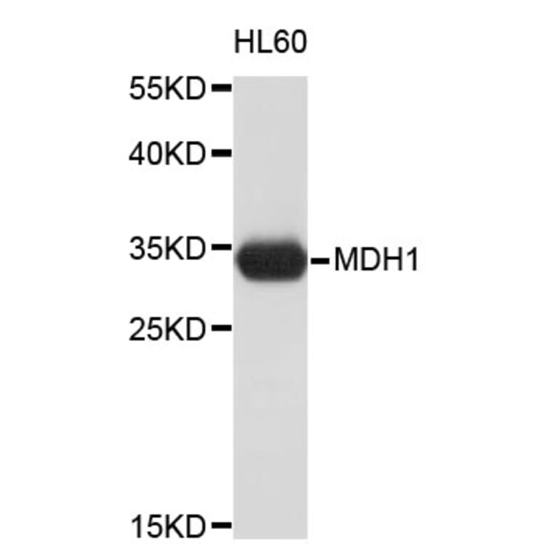 Western Blot - Anti-MDH1 Antibody (A3955) - Antibodies.com