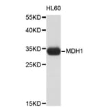 Western Blot - Anti-MDH1 Antibody (A3955) - Antibodies.com