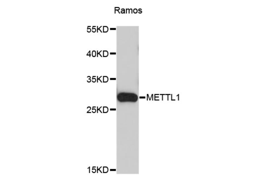 Western Blot - Anti-METTL1 Antibody (A3958) - Antibodies.com