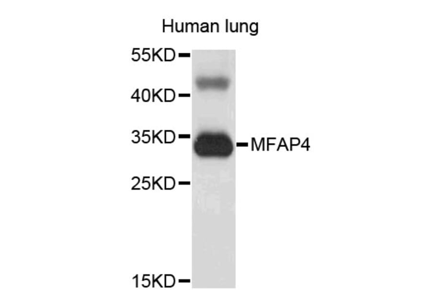 Western Blot - Anti-MFAP4 Antibody (A3959) - Antibodies.com