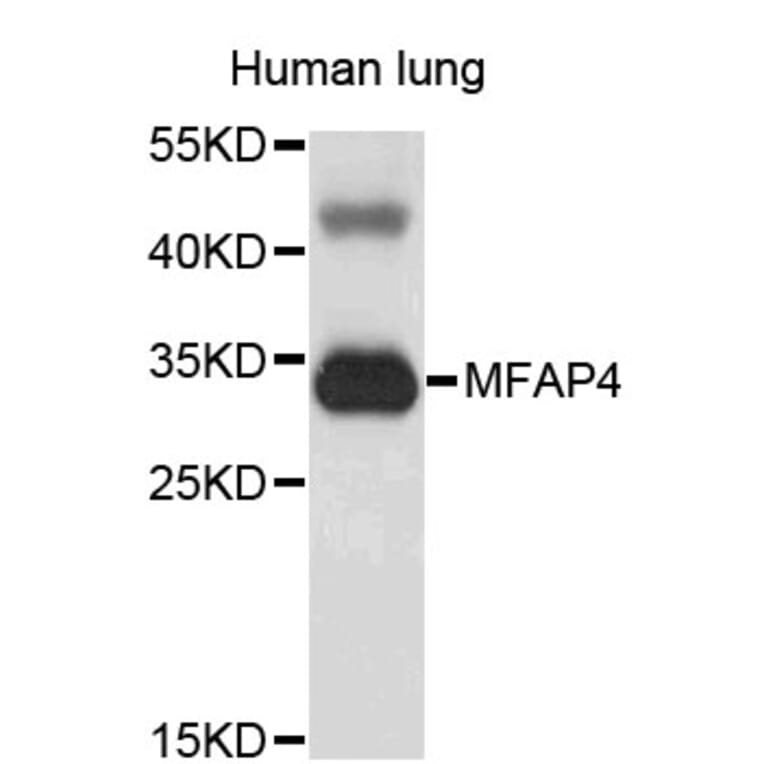 Western Blot - Anti-MFAP4 Antibody (A3959) - Antibodies.com