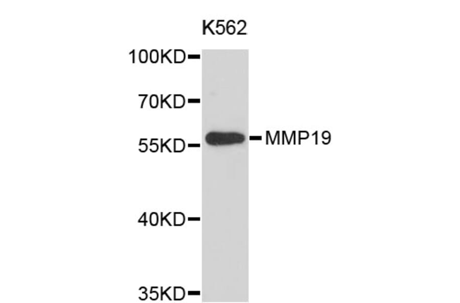 Western Blot - Anti-MMP19 Antibody (A3962) - Antibodies.com