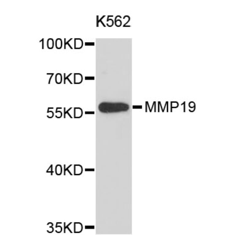 Western Blot - Anti-MMP19 Antibody (A3962) - Antibodies.com