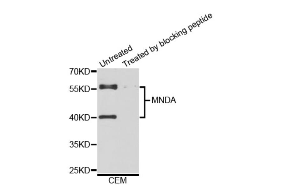 Western Blot - Anti-MNDA Antibody (A3963) - Antibodies.com