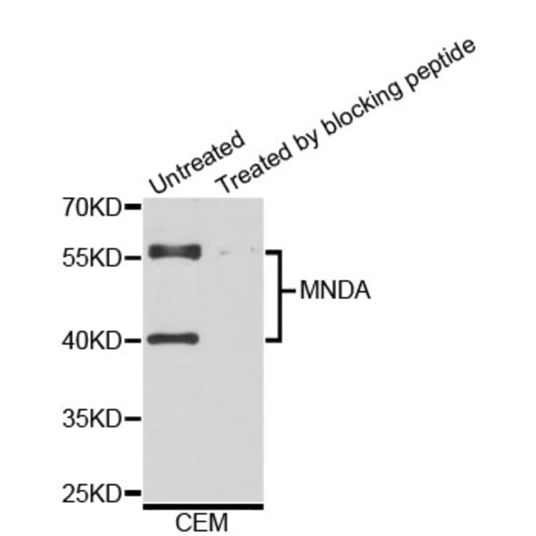 Western Blot - Anti-MNDA Antibody (A3963) - Antibodies.com