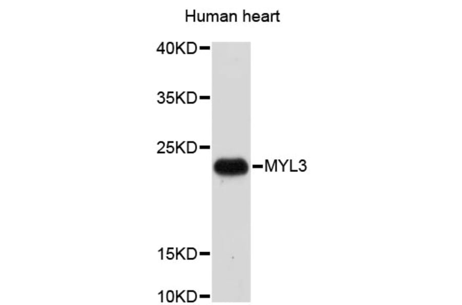 Western Blot - Anti-MYL3 Antibody (A3970) - Antibodies.com