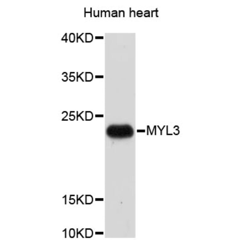 Western Blot - Anti-MYL3 Antibody (A3970) - Antibodies.com