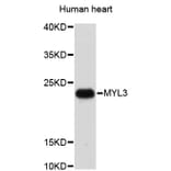 Western Blot - Anti-MYL3 Antibody (A3970) - Antibodies.com