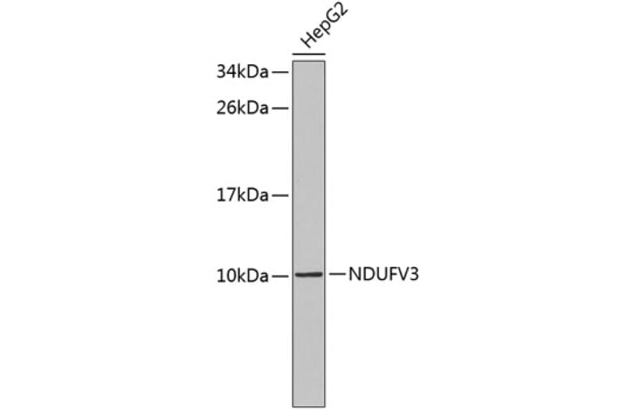 Western Blot - Anti-NDUFV3 Antibody (A3986) - Antibodies.com