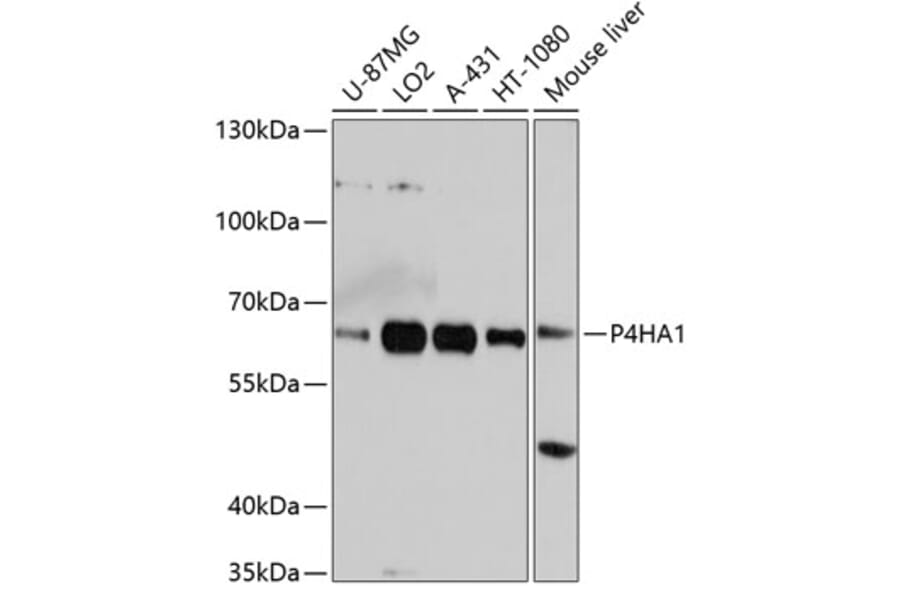 Western Blot - Anti-P4HA1 Antibody (A3999) - Antibodies.com
