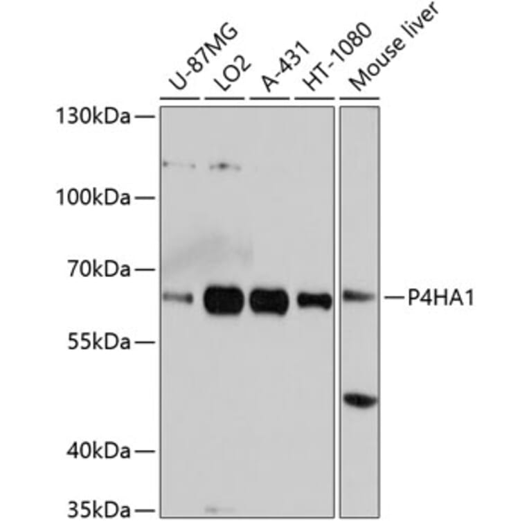 Western Blot - Anti-P4HA1 Antibody (A3999) - Antibodies.com