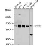 Western Blot - Anti-P4HA1 Antibody (A3999) - Antibodies.com