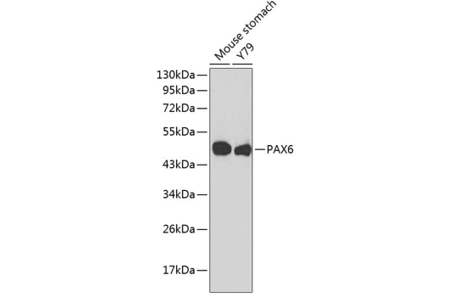 Western Blot - Anti-PAX6 Antibody (A4003) - Antibodies.com