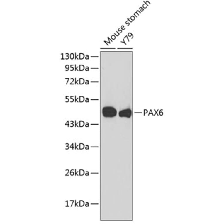 Western Blot - Anti-PAX6 Antibody (A4003) - Antibodies.com