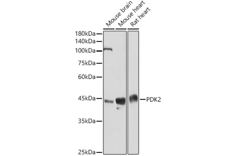 Western Blot - Anti-PDK2 Antibody (A9351) - Antibodies.com