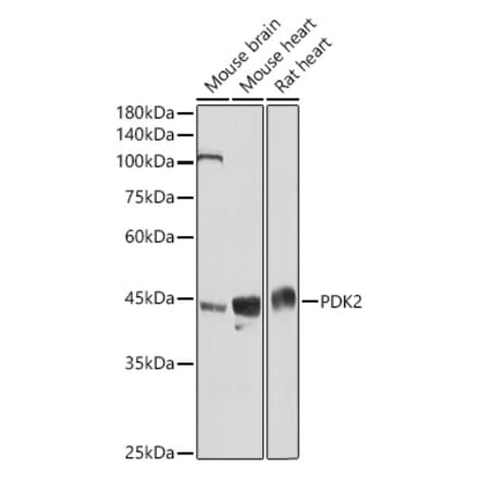 Western Blot - Anti-PDK2 Antibody (A9351) - Antibodies.com