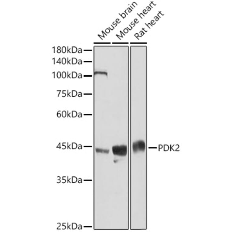 Western Blot - Anti-PDK2 Antibody (A9351) - Antibodies.com