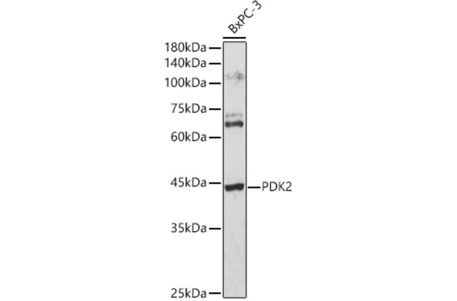 Western Blot - Anti-PDK2 Antibody (A9351) - Antibodies.com