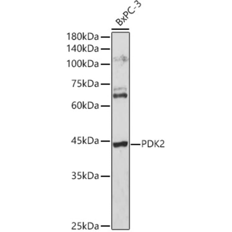 Western Blot - Anti-PDK2 Antibody (A9351) - Antibodies.com