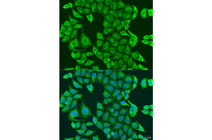 Immunofluorescence - Anti-PDK2 Antibody (A9351) - Antibodies.com