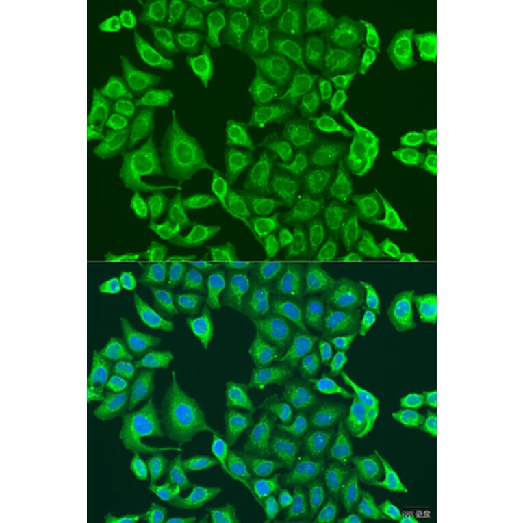 Immunofluorescence - Anti-PDK2 Antibody (A9351) - Antibodies.com