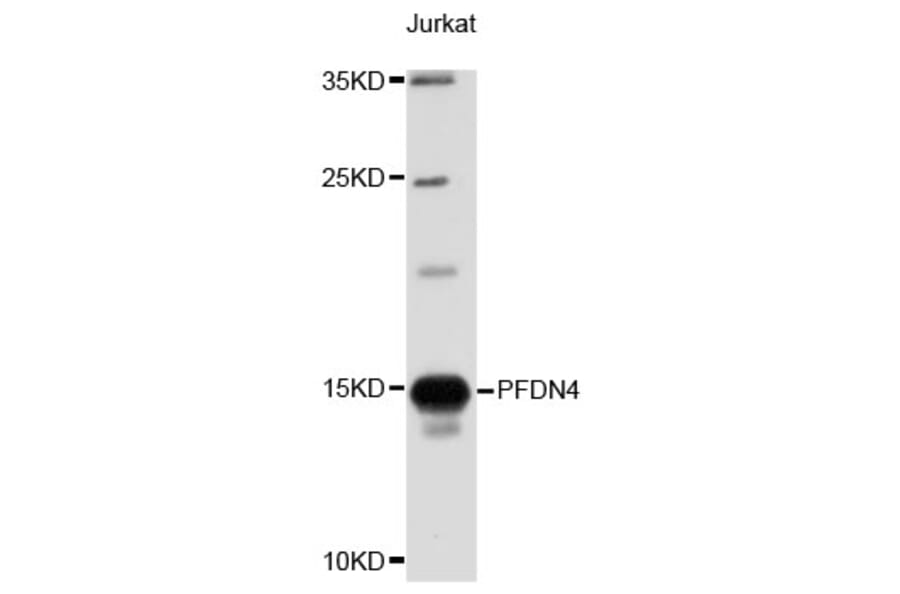 Western Blot - Anti-PFDN4 Antibody (A4013) - Antibodies.com