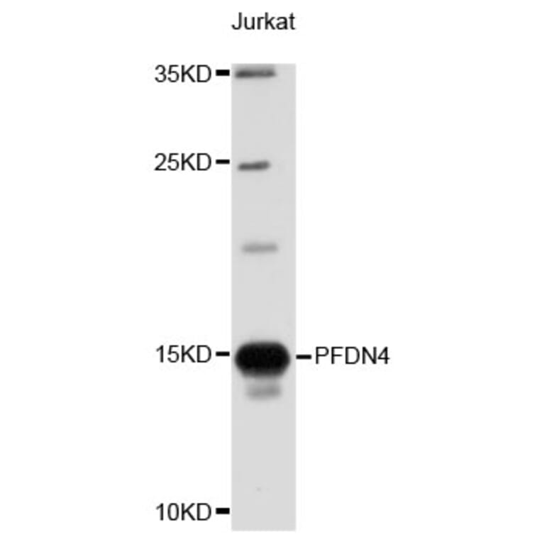 Western Blot - Anti-PFDN4 Antibody (A4013) - Antibodies.com