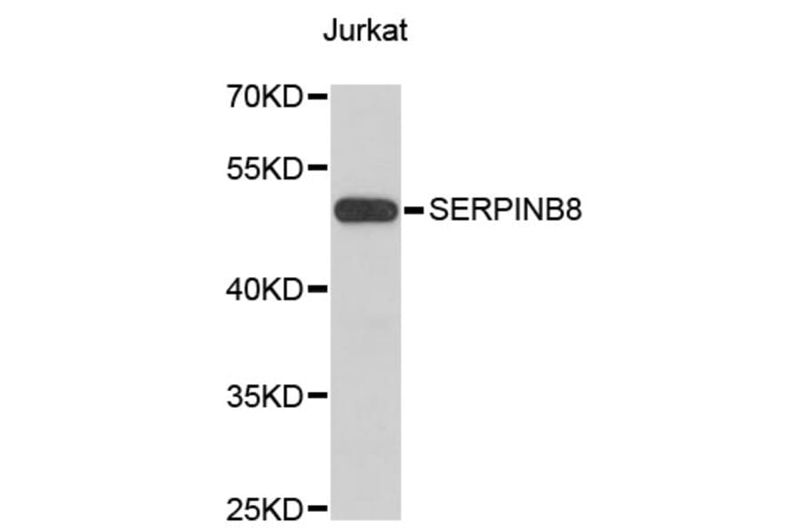 Western Blot - Anti-SERPINB8 Antibody (A4020) - Antibodies.com