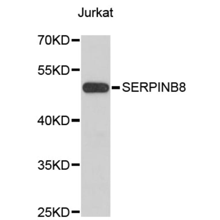 Western Blot - Anti-SERPINB8 Antibody (A4020) - Antibodies.com
