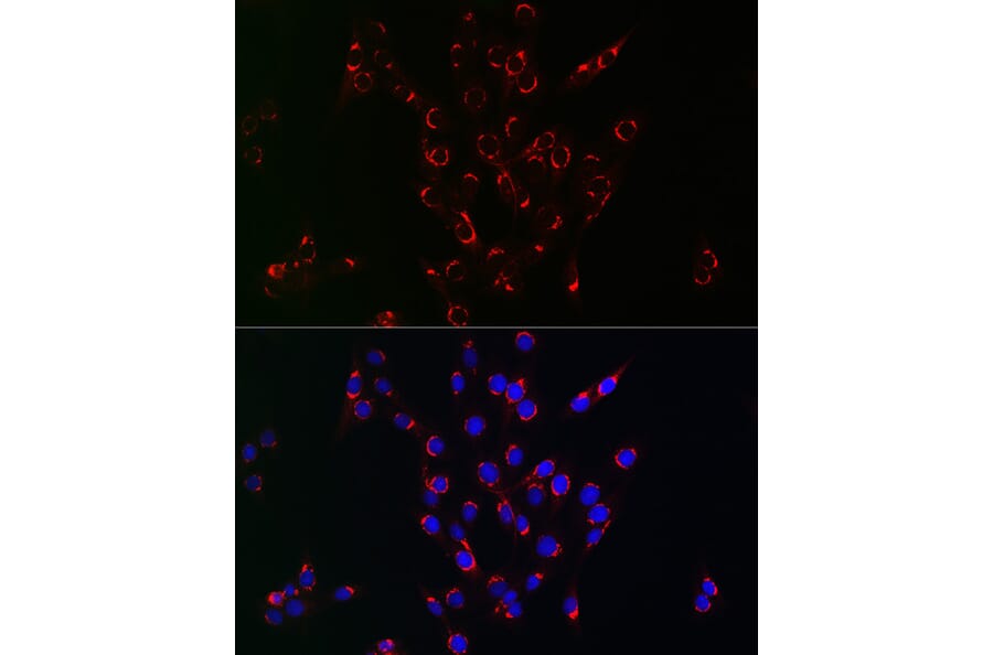 Immunofluorescence - Anti-VPS34 Antibody (A9355) - Antibodies.com