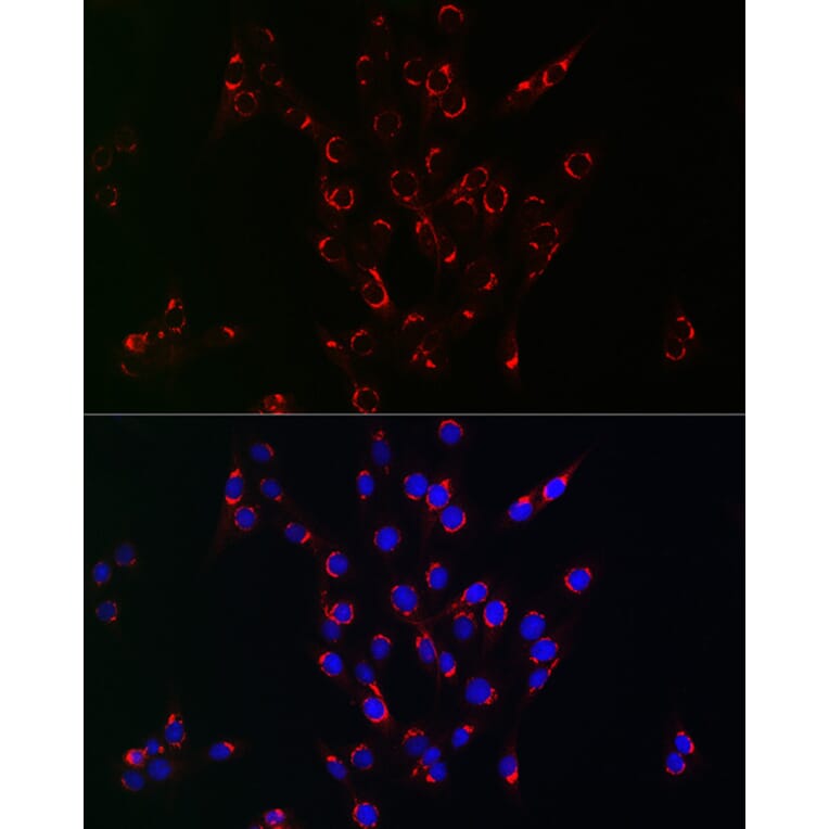 Immunofluorescence - Anti-VPS34 Antibody (A9355) - Antibodies.com
