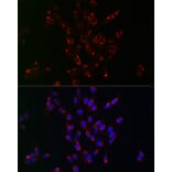 Immunofluorescence - Anti-VPS34 Antibody (A9355) - Antibodies.com