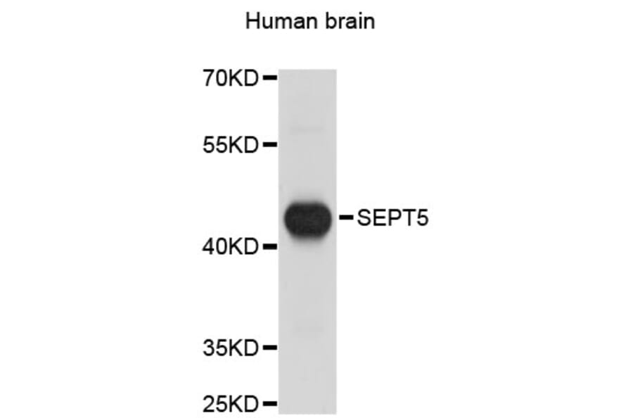 Western Blot - Anti-SEPT5 Antibody (A4029) - Antibodies.com