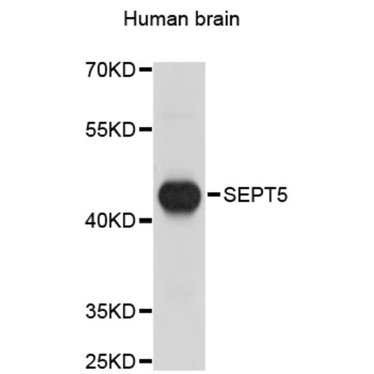 Western Blot - Anti-SEPT5 Antibody (A4029) - Antibodies.com